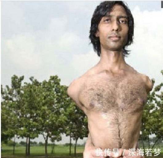 男孩|印度男孩胳膊能够绕到身体后面,韧性极强的“橡胶人”,厉害了