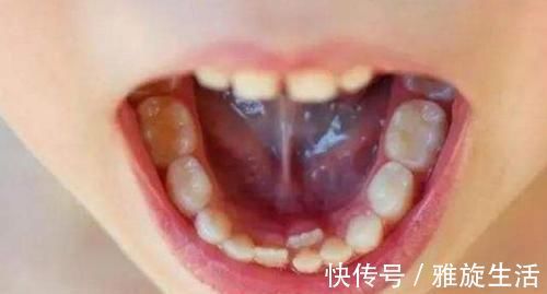孩子|孩子“乳牙”脱落别着急扔,关键时刻能救命不懂为啥尽快了解下