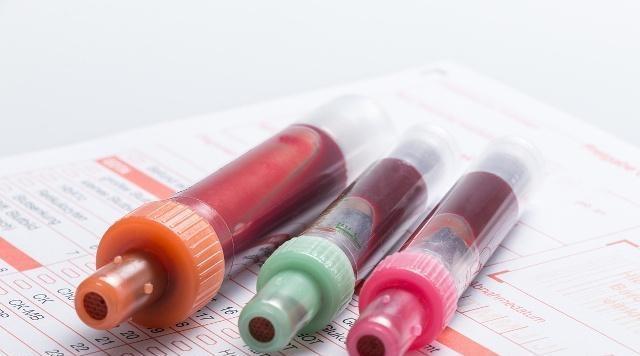 翻倍|黄芪泡水如何搭配才更有效？中医：若能如此搭配，养生效果直翻倍