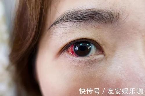 血压|专家提醒:高血压患者,这些水果尽量别接触,或不利于控制血压