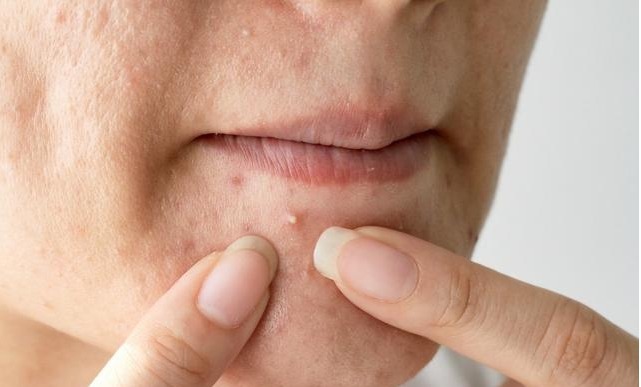 女性朋友|子宫好不好要看脸,如果脸上出现5个变化,说明子宫不健康