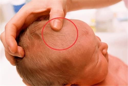 大脑|宝宝卤门护理有多重要?如果出现这些情况,要尽快带娃去医院