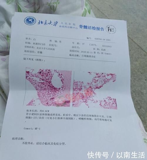 淋巴细胞|白血病“恋上”儿童,远离这几样东西,再贵也不能碰