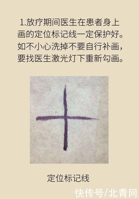 肿瘤|一半以上的肿瘤需要放疗，害怕辐射不如了解一下