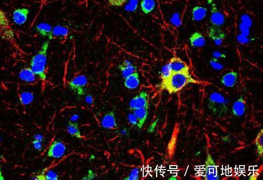 變瘦|人變瘦的最快方法是什么？以慢打快，腳踏實地，才是最快減肥之道