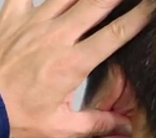  胰腺|耳后有个“降糖窝”，每天按一按，降血糖，刺激胰腺，预防并发症