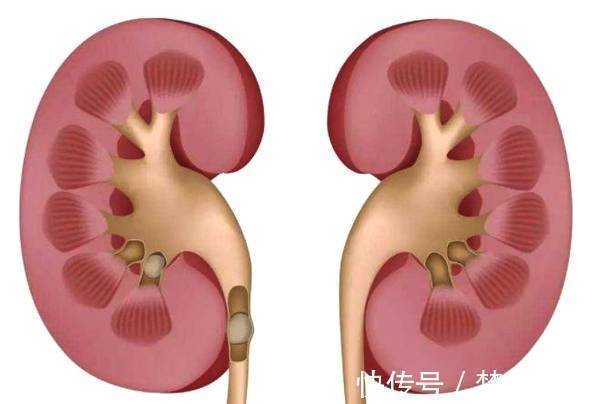 糖尿病|它是“天然胰岛素”,泡水喝一喝,助你降血糖、远离糖尿病