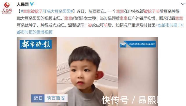 胆红素|痒、肿、挠破还留疤!娃被蚊子亲吻后,3招止痒、消肿!