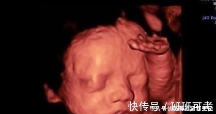 宝妈|孕期做四维有什么好处,什么时候做最好这个时候做是最好的