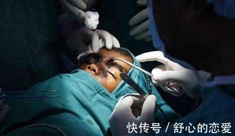 长相|9岁女孩因长相奇怪被称为“半脸怪物”,术后让人大开眼界