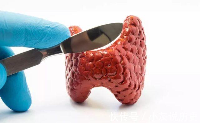 补充营养|身体露出3个“马脚”,或是甲状腺癌来“敲门”,别不当回事