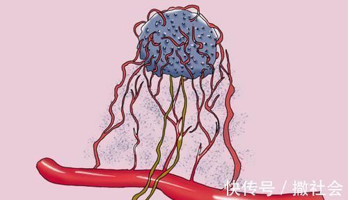 免疫系统|为何有的癌症患者一年就复发,有人却20年才复发?