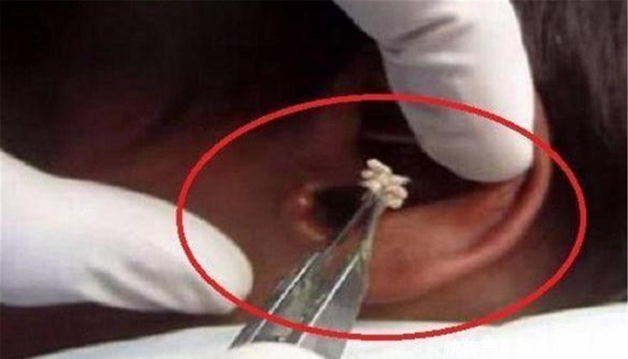 5岁儿子耳朵疼,送医后医生怒斥宝妈无知这3种东西别放孩子床头