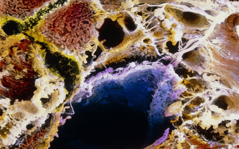 寿命比较短的人,身上这两处比较硬,如果你一个都不占,那恭喜你