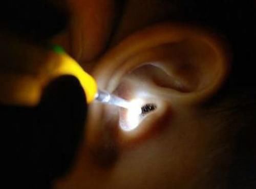 医院|4岁女儿总要妈妈帮挖耳朵,但也挖不出东西,去了医院才真相大白