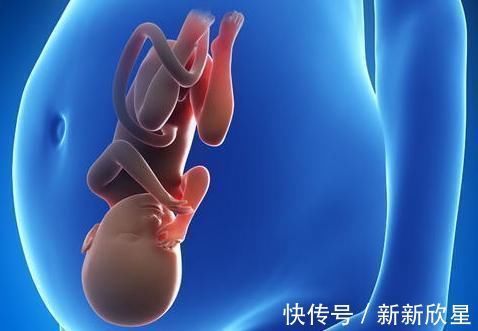 怀孕|怀孕10个月辛苦“倒立”的胎儿也不轻松，为啥娃要大头朝下