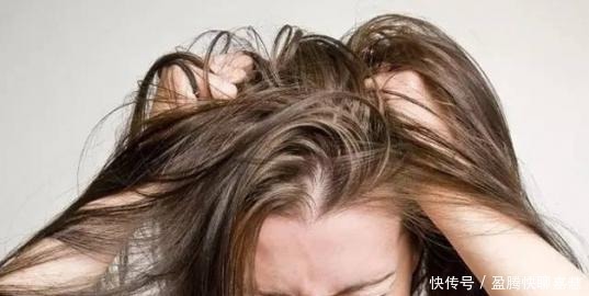 油脂|头发爱出油的你，要不要天天洗头？这样洗头对头皮更好！