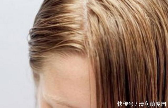 头发多久洗一次最好？很多人都不知道，难怪脱发越来越厉害
