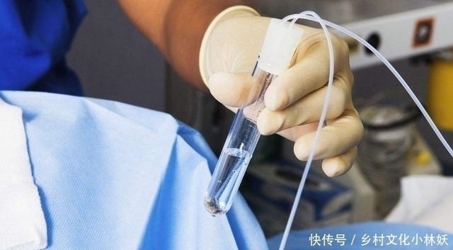 二胎|为何很多女明星都能生“双胞胎”原来并非巧合，和这些因素有关