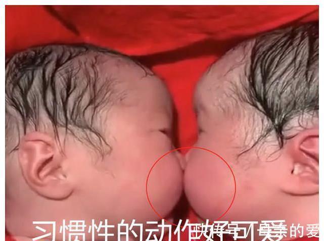 尿不湿|龙凤胎兄妹出生后一直亲,护理人员都没办法分开,画面太暖心了
