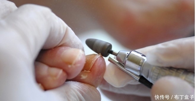 手脚|糖友们请当心，当手脚出现这些症状，糖尿病足或许已经不远了