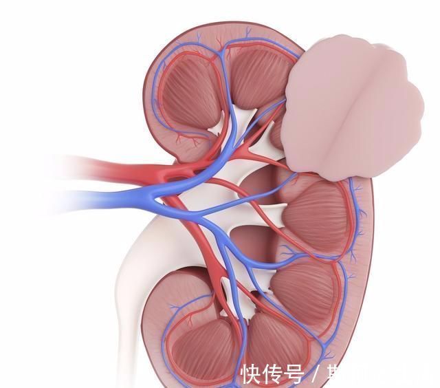 餐后血糖|二甲双胍单用效果不理想？给你3种联用方案，降糖效果加倍