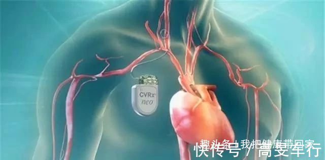 舒张压|高血压高压150，低压100，是不是比较严重？今天来告诉各位答案