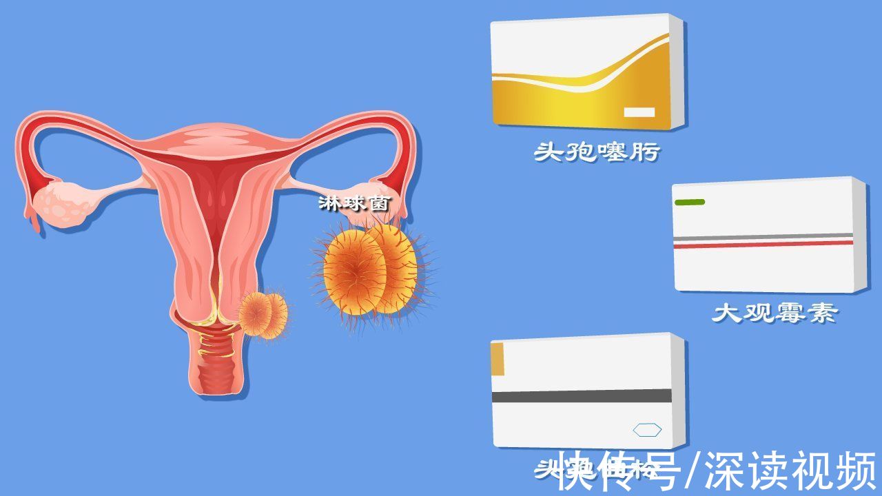 抗生素|得了淋病遭罪不说,还易复发,该咋办?快看看你的药都用对了吗?