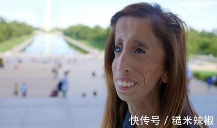 丽斯|她是世界上最瘦最丑的女人,体重不超过29公斤,却活出最美丽样子