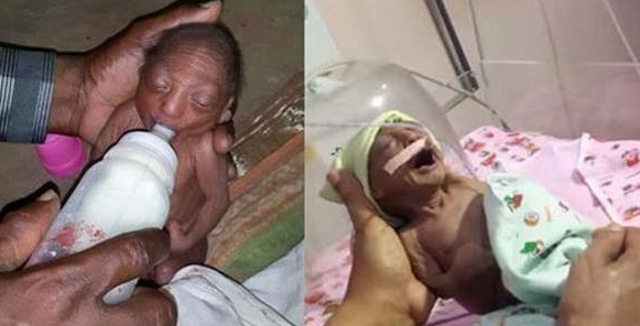迪利|母亲生下宝宝,奇丑无比狠心抛弃,爷爷喂奶抚养长大创造奇迹