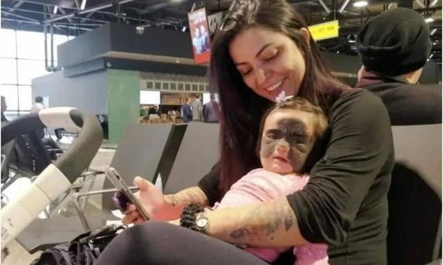 屁股|宝宝身上有淤青是来给父母报恩的如果胎记长成这样,家长要重视