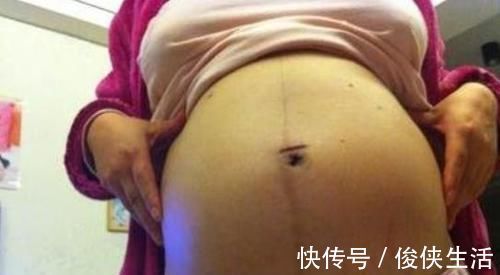 备孕|孕妈怀上双胞胎，全家兴高采烈，检查后医生却说：那不是孩子！