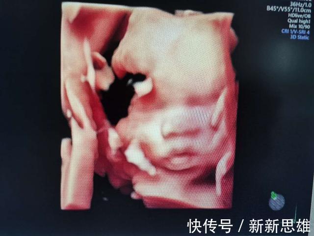 分体|四维彩超什么时候做4项准备孕妈提前做好,检查才会更顺利