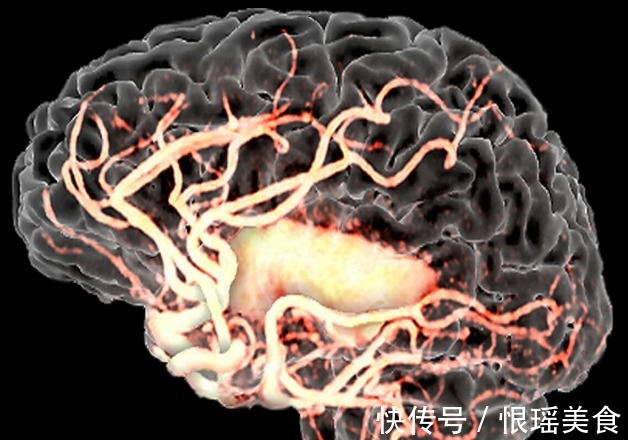 中老年人|中老年人补充叶酸有2大益处,如何正确补充本文给出3个建议