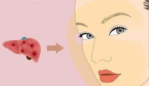 肝脏是否出现硬化,手脚会先知,肝硬化后手脚有哪些表现