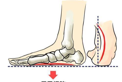 大姐|大姐骨折、小腿肌肉萎缩的起因是“老人鞋”?买老人鞋别交孝心税