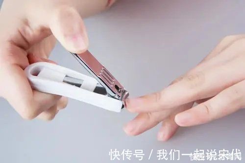甲周|指甲剪短点才干净？小心，越短越容易患这种病