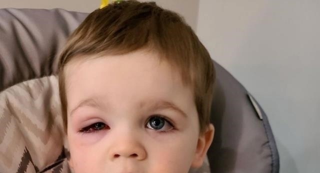 男孩|洗澡鸭险致男孩双目失明,这类网红玩具一定要经常更换,父母注意