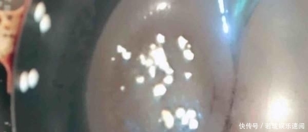 肚腩|真正的“刮油王”是它,隔天吃一些,清早排出隔夜黑臭便,无肚腩