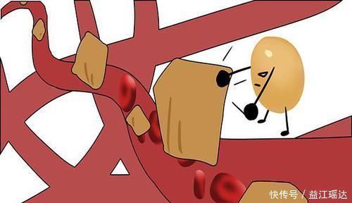 稳定血糖|花生有了新发现!研究指出:2种吃法利血管,减重降脂稳定血糖