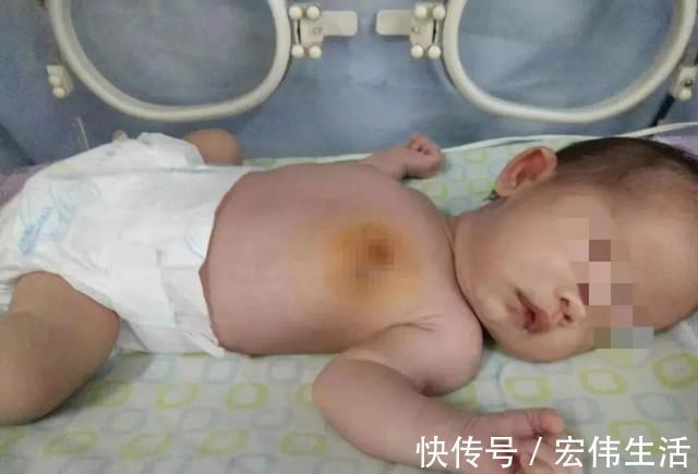 乳头|宝宝哭闹不止,妈妈掀开衣服后瞬间爆炸:原来是奶奶做了“手脚”