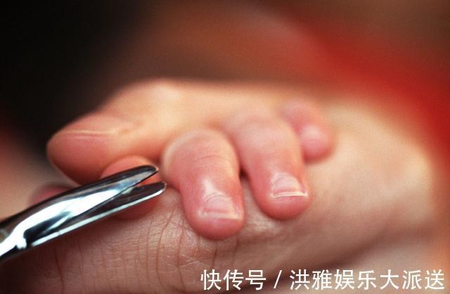 手指|孩子手指总是长倒刺不小心处理易感染,形成原因值得家长关注