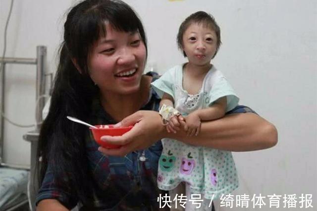 脑门封闭症|女子生下一只“猴女孩”,马戏团欲花大价钱收购,宝妈:她是孩子