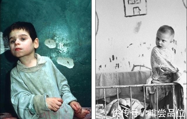 营养不良|孤儿院的厨娘长得又白又胖, 孤儿们严重营养不良骨瘦如柴