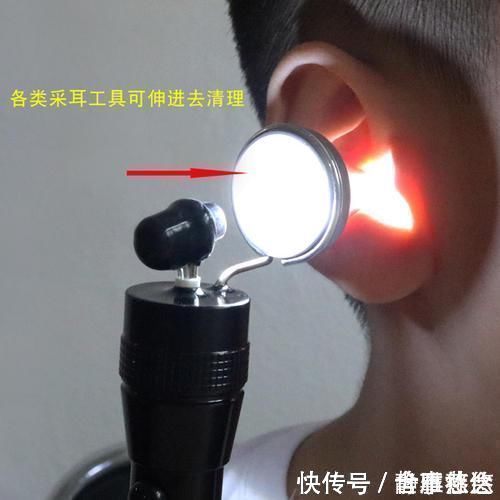 虫子|虫子飞进3岁孙女耳朵,奶奶一个举动救了孩子,医生直夸:有文化