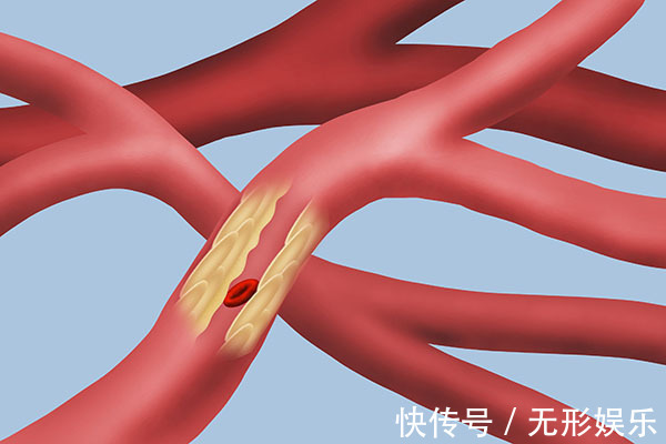 A型、B型、AB型、O型血,有什么不同哪种血型生病率更高