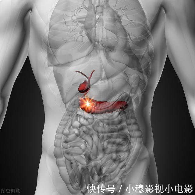 恶性|新晋“癌症之王”胰腺癌，恶性程度超过肝癌，发病率竟增加一倍