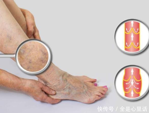 分钟|每天坚持“踮脚”10分钟,4个问题会悄悄远离你,别说没有告诉你