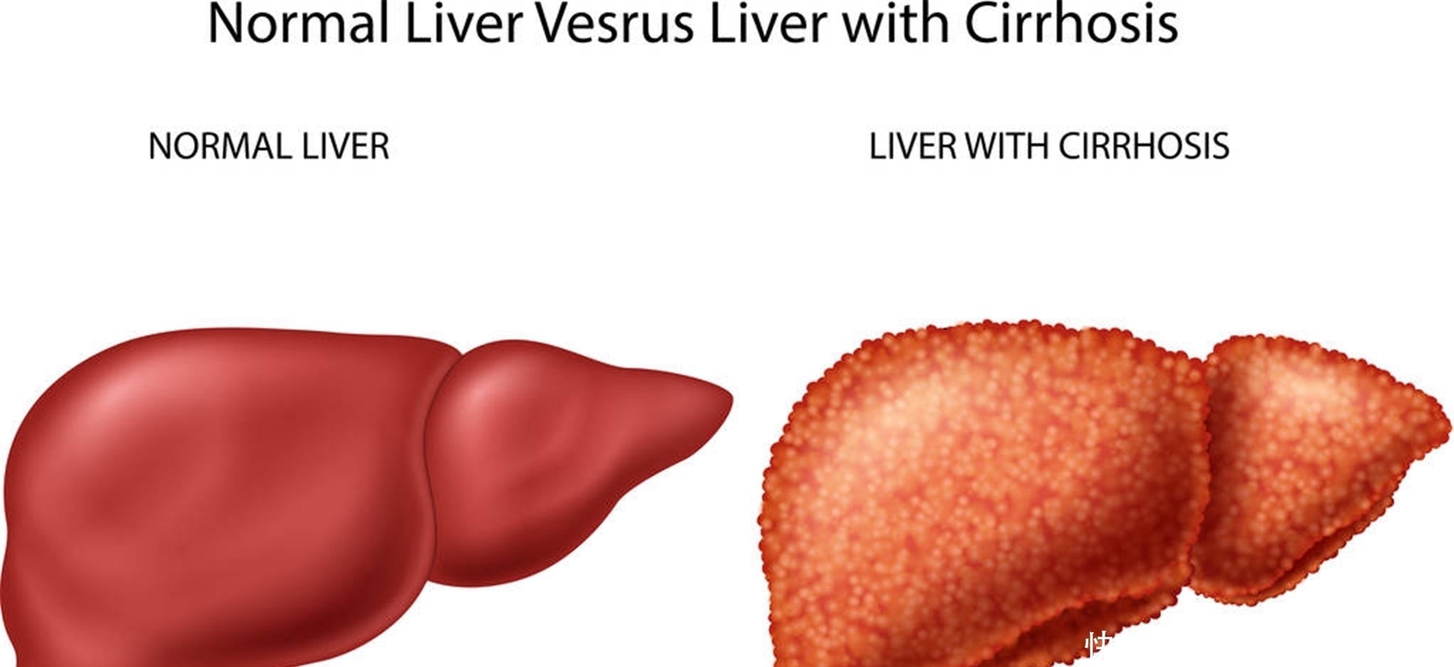 陈皮|陈皮和它“天生一对”,泡水喝点,健脾养肝,血管干净不堵塞