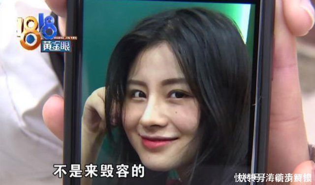 整形手术|女子整容花了6万多,整了个巫婆鼻,女子医生审美有问题